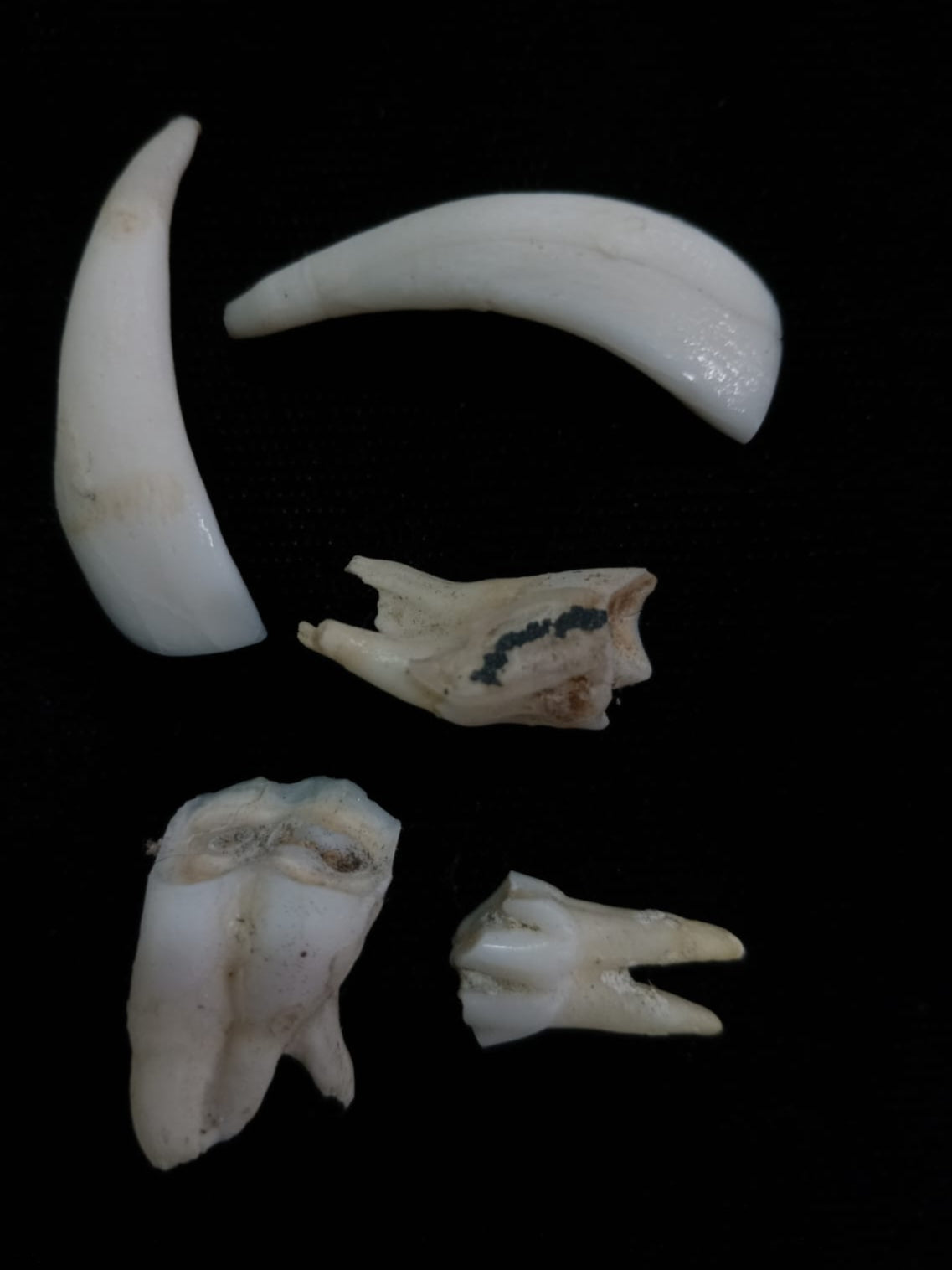 Bone Set 2